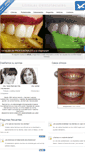 Mobile Screenshot of clinicasdentofaciales.com