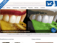 Tablet Screenshot of clinicasdentofaciales.com
